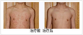 ݡǰԱ